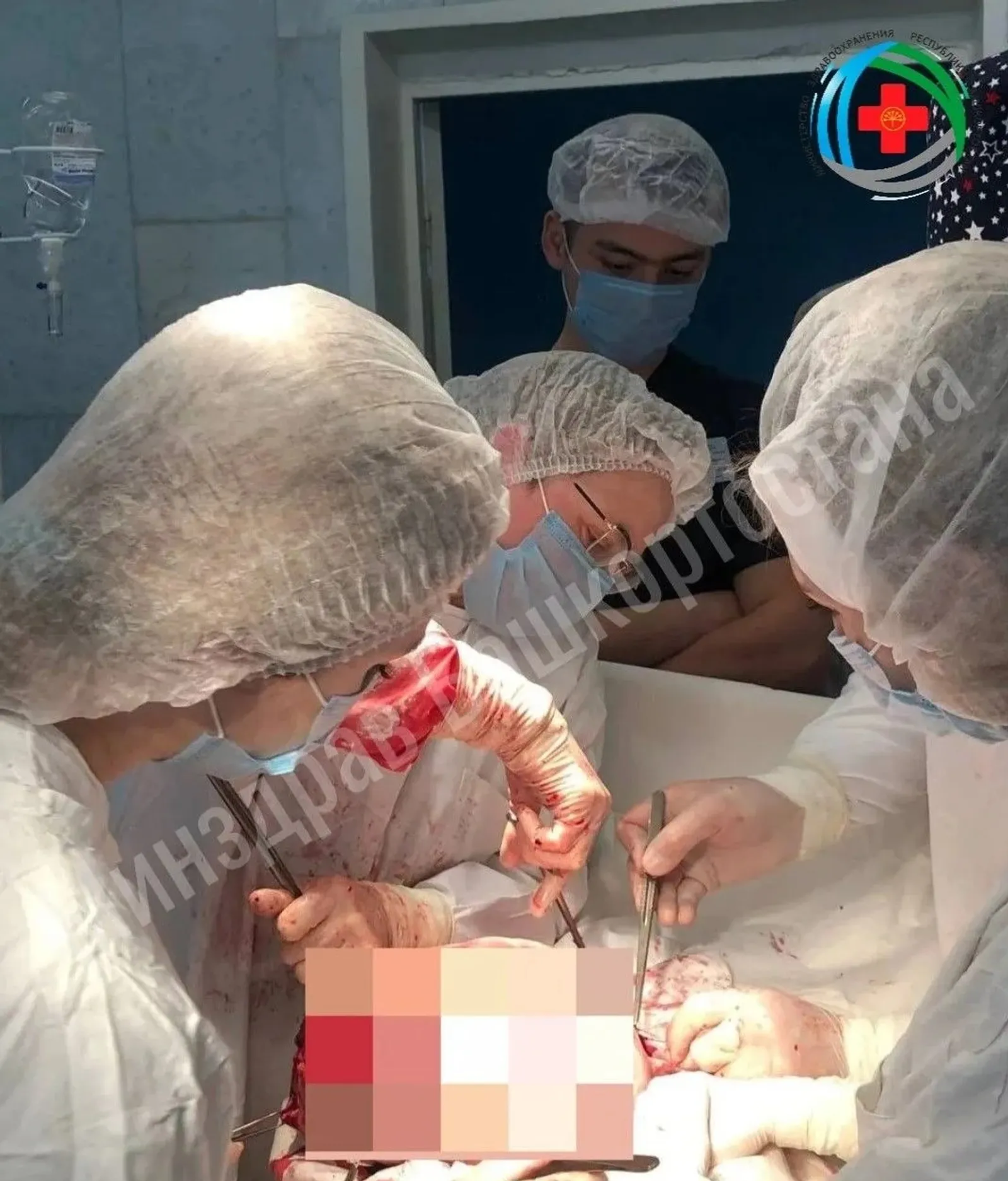 В Башкирии врачи удалили у пациентки гигантскую миому матки