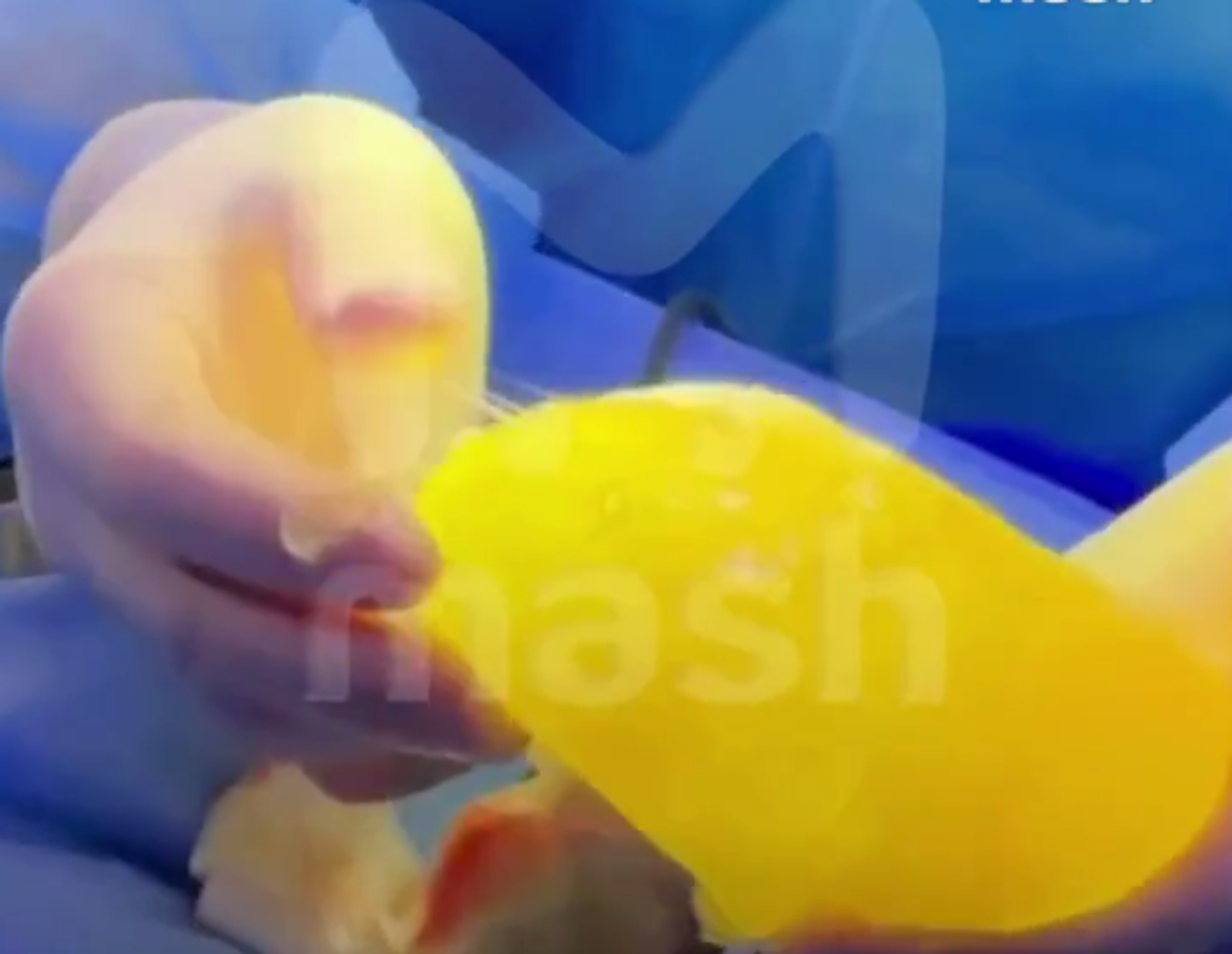 У девушки-блогера из Уфы во время тренировки взорвалась силиконовая грудь