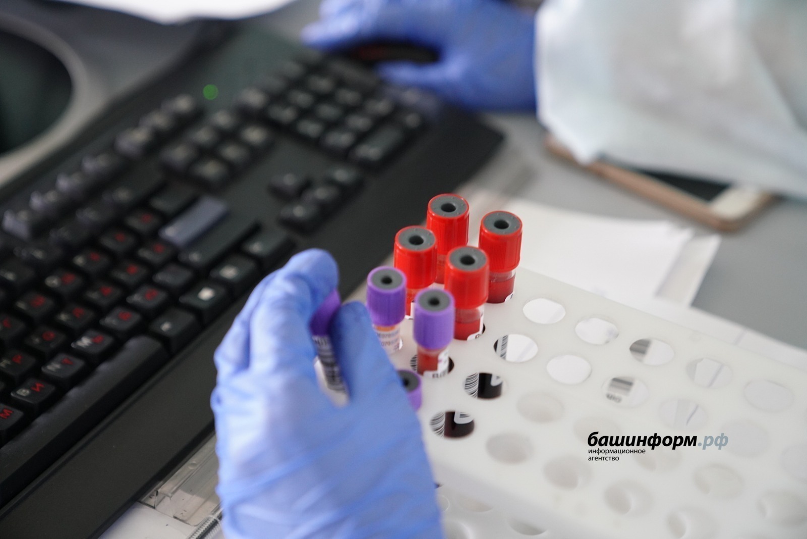 Три человека заразились бешенством в Башкирии